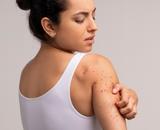 Kun je bultjes krijgen van huisstofmijt?