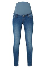 Noppies Noppies jeans - Avi - skinny - authentic blue  50N1011 P310
