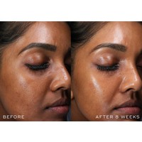 Medik8 r-Retinoate Intense - Night cream r-Retinoate Intense - Night cream