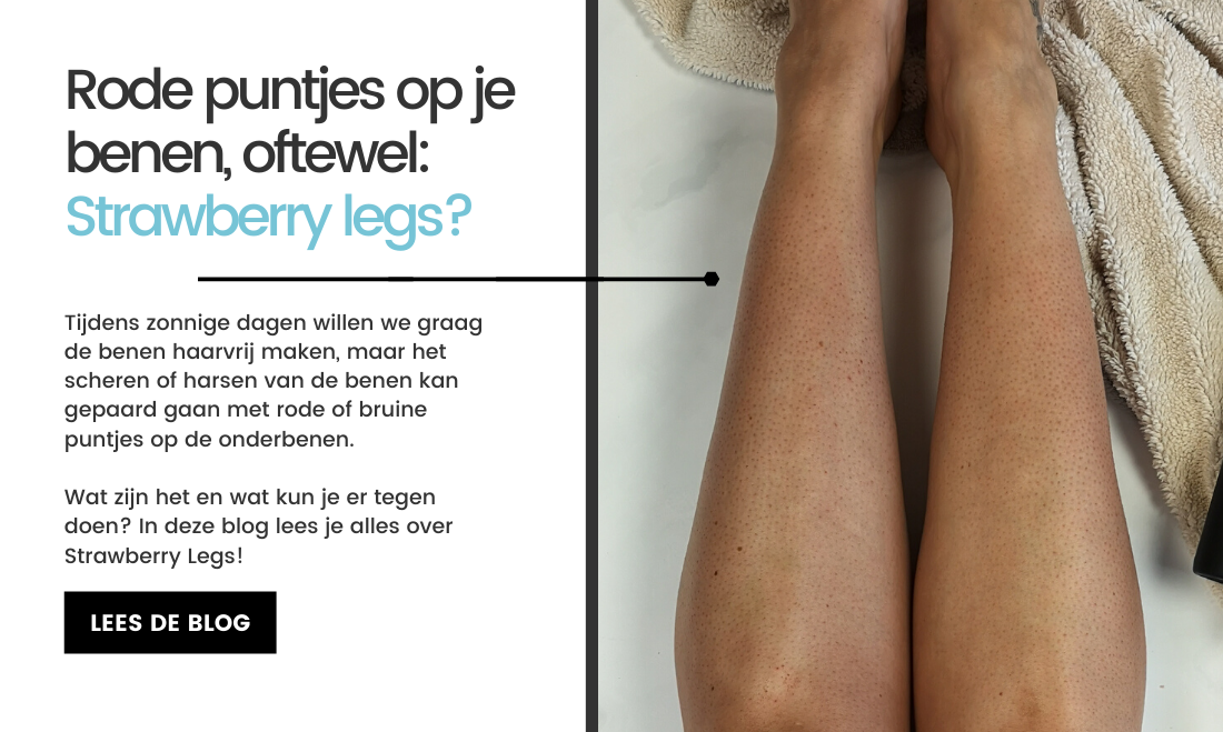 Rode of puntjes je benen, Strawberry Legs? - Care Skin