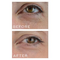 Medik8 Crystal Retinal 1 Crystal Retinal 1