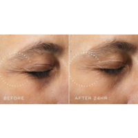 Medik8 Crystal Retinal Ceramide Eye 6 Crystal Retinal Ceramide Eye 6