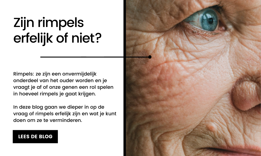 Zijn rimpels erfelijk of niet? - Care for Skin
