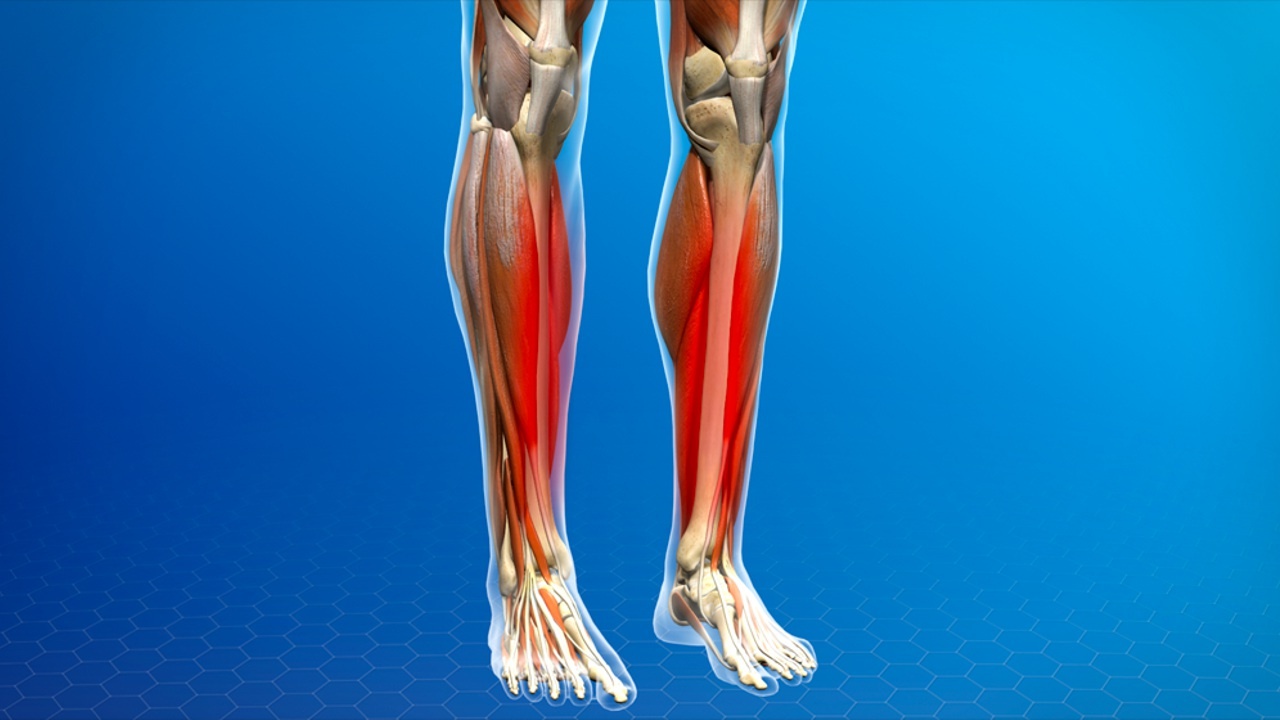 Hoe weet je of je shin splints hebt?