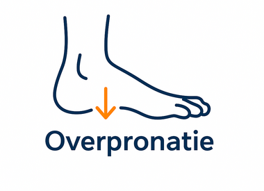 Overpronatie