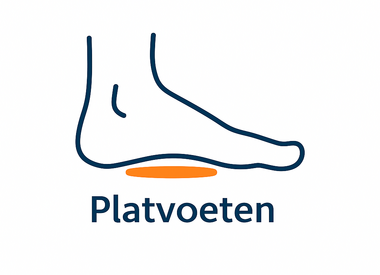 Platvoeten