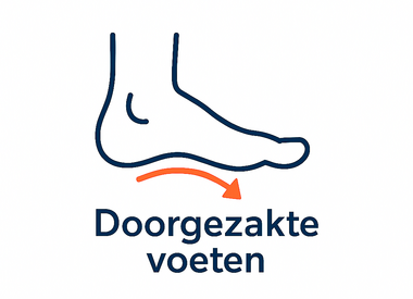 Doorgezakte voet