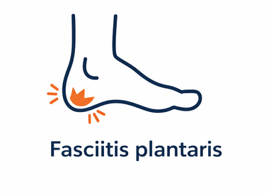 Fasciitis Plantaris