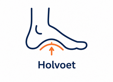 Holvoeten