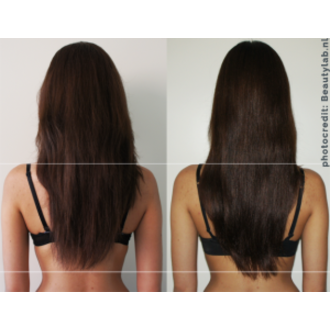 FAST haargroei versnellende kuur - Shampoo en Conditioner voor Snellere Haargroei -  Sulfaat- en Parabeenvrij