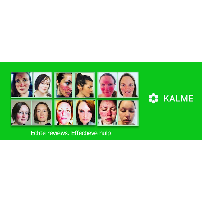 Kalme dag- en nachtcrème Rosacea huidverzorging