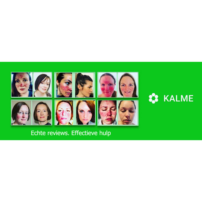 Kalme Skin Care Basic Kit - huidverzorging Rosacea basis kit