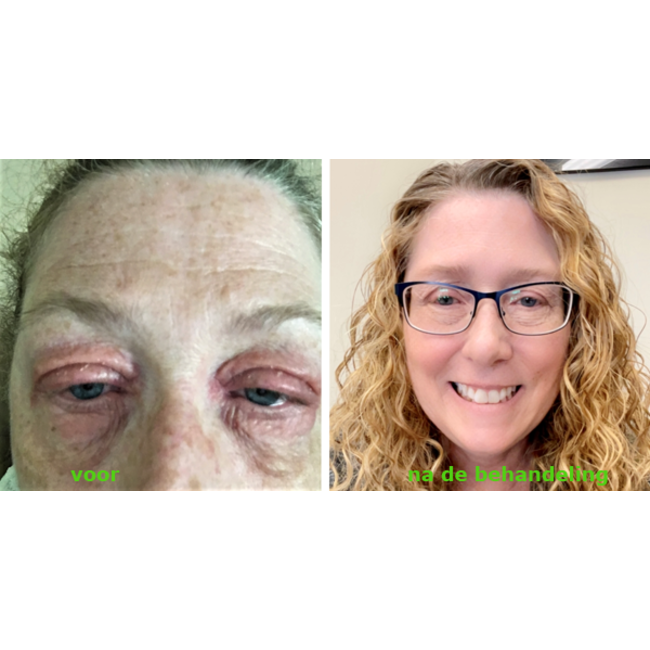 Hydrosil Dry Eye Duo Care Pack