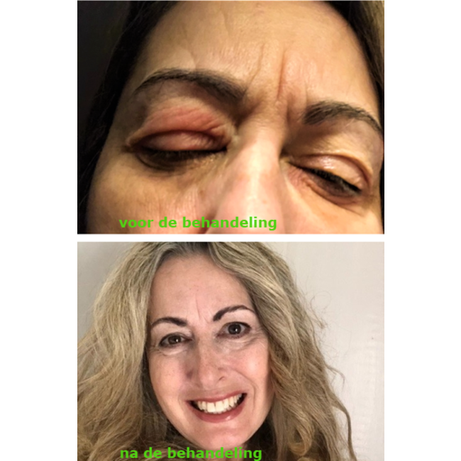 Hydrosil Dry Eye Duo Care Pack Oog gel en Concealer Duo aanbieding Nisim