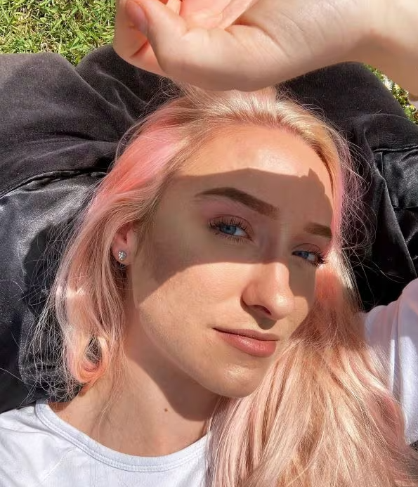 Taylor in de zon na de behandeling van haar cystische acne