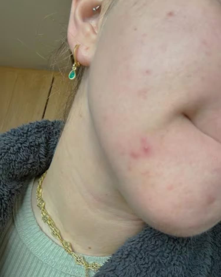 De huid oogt rustiger en egaler