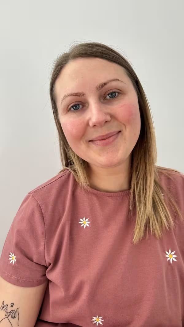 Bianca-rosacea-na-de-behandeling