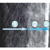 Nano Clean Vervangingsfilter