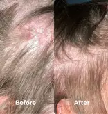 Sea Magik Sea Magik 3 Seaweed Scalp Mud | Kalmerend Hoofdhuidmasker