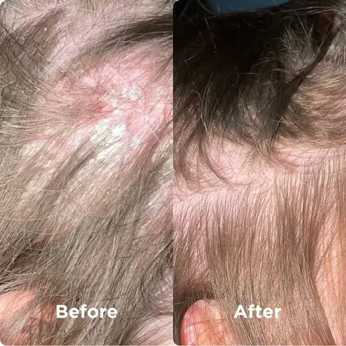Sea Magik Sea Magik 3 Seaweed Scalp Mud | Scalp Treatment Sea Magik Sea Magik 3 Seaweed Scalp Mud | Scalp Treatment