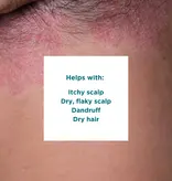 Sea Magik Sea Magik 3 Seaweed Scalp Mud | Scalp Treatment