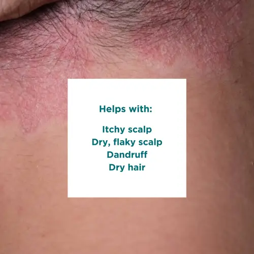 Sea Magik Sea Magik 3 Seaweed Scalp Mud | Scalp Treatment Sea Magik Sea Magik 3 Seaweed Scalp Mud | Scalp Treatment