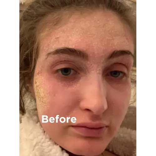 Sea Magik Sea Magik 21 Mineral Mist | Hydrating Dead Sea Mineral Face Mist Sea Magik Sea Magik 21 Mineral Mist | Hydrating Dead Sea Mineral Face Mist