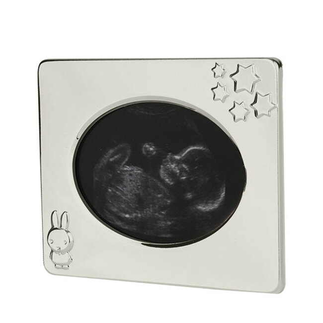 Zwangerschap cadeaupakket Echolijstje Platinum