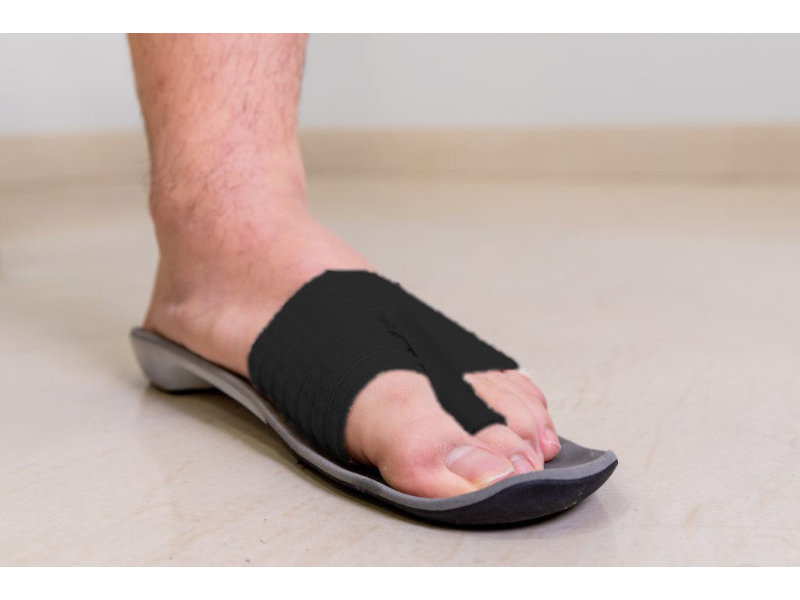 Fixtoe Pro – hulpmiddel bij voorvoetpijn en zwevende teen