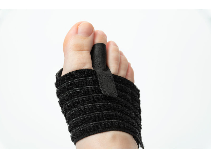 Fixtoe Pro – hulpmiddel bij voorvoetpijn en zwevende teen
