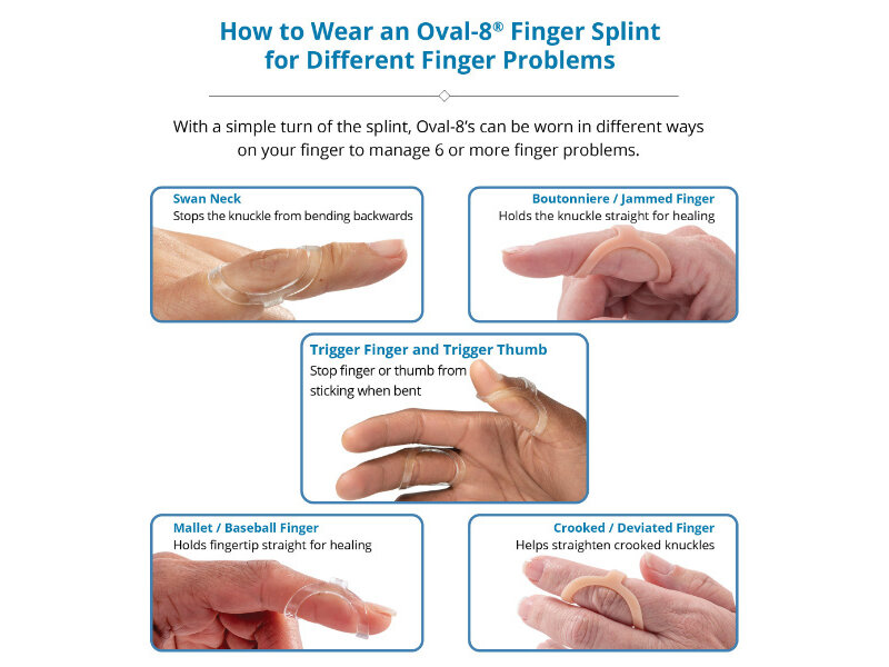 3 Point Products Oval-8® - Finger Splints - Clear - 5 pièces