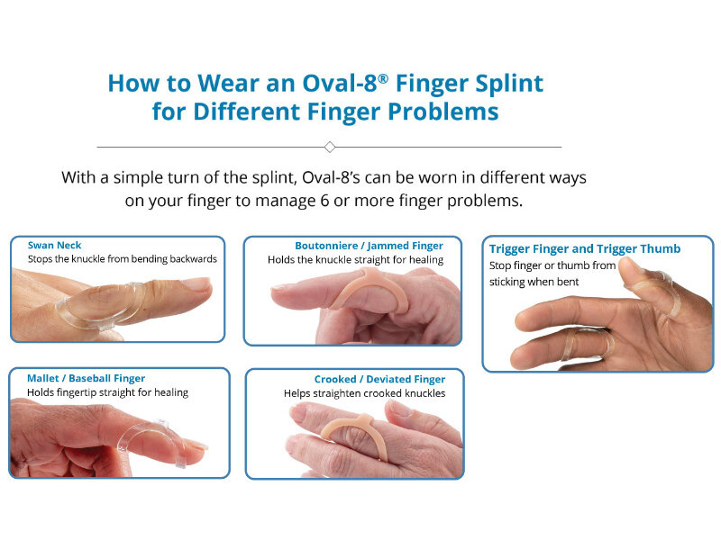 3 Point Products Oval-8 ® - Finger Splints -Clear - sizing set