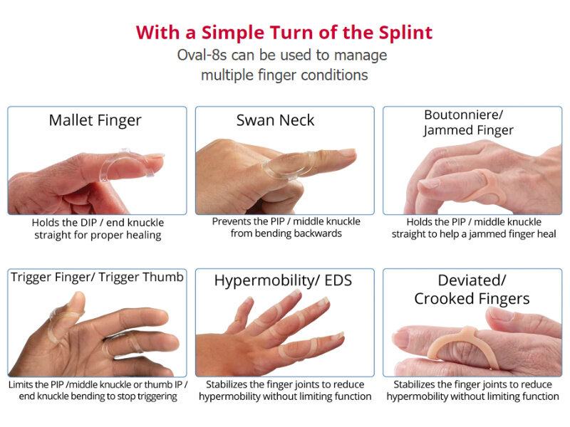 3 Point Products Oval-8® Finger Splint ensemble de 3 pièces