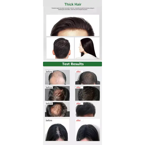 Dexe Dexe - Haarverzorgingslotion - Vermindert haaruitval, stimuleert haargroei - Voedt hoofdhuid en versterkt de haarwortels - Man/vrouw - 120ml