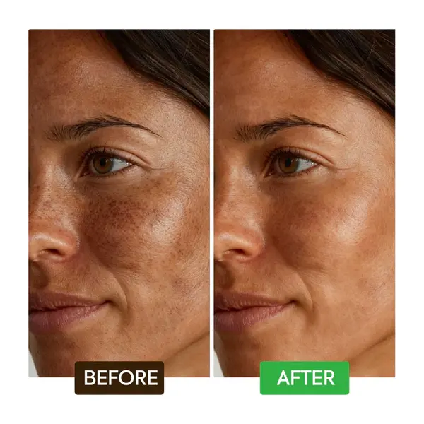 Makari Makari Kojic Acid Dark Spot Remover Exfoliërende Zeep Bars met Vitamine C & Retinol