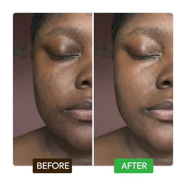 Makari Makari Kojic & Azelaic Brightening Serum met 10% Azelaic Acid & 1% Kojic Acid – 33ml