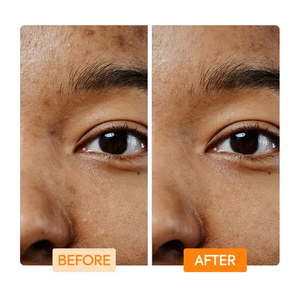 Makari Makari IYKYK Reinigingszeep met Vitamine C & Kurkuma voor een stralende, egale teint – 100g