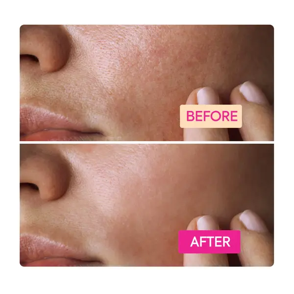 Makari Makari IYKYK Niacinamide Cleansing Bar for Refined Pores & Even Skin Tone – 100g