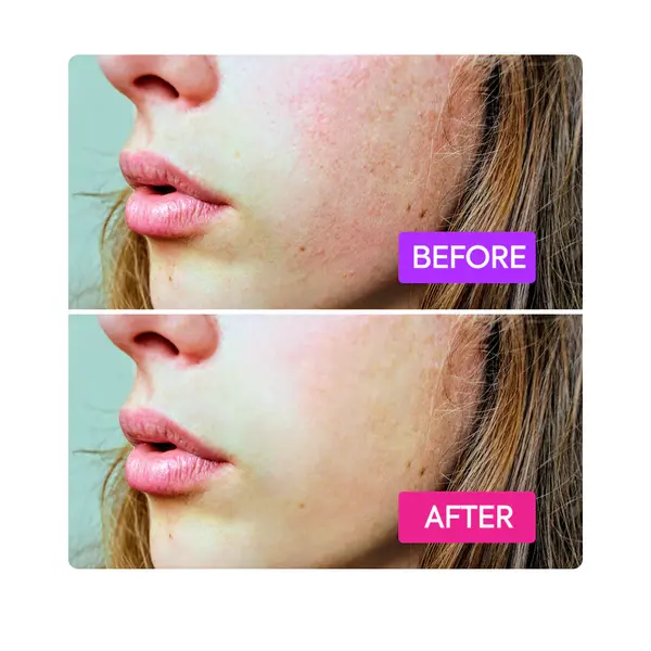 Makari Makari IYKYK Probiotics Booster – Kalmerend & Huidbarrière Versterkend Serum 80ml