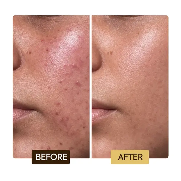 Makari Makari SKIN REPAIRING AND CLARIFYING SERUM 40ml