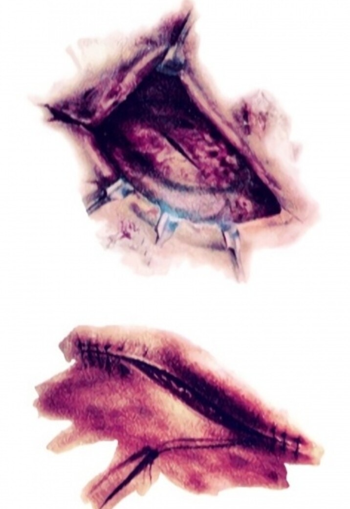 Tijdelijke Tattoo van Bloederige Wonden