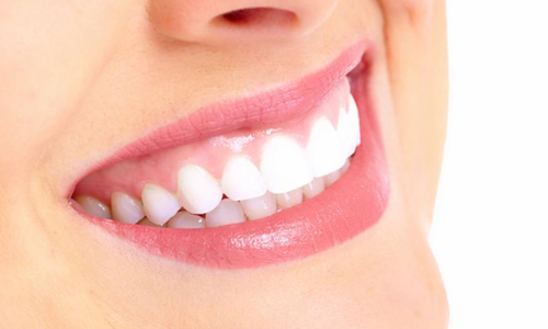Blog - Hoe krijg ik witte tanden? -