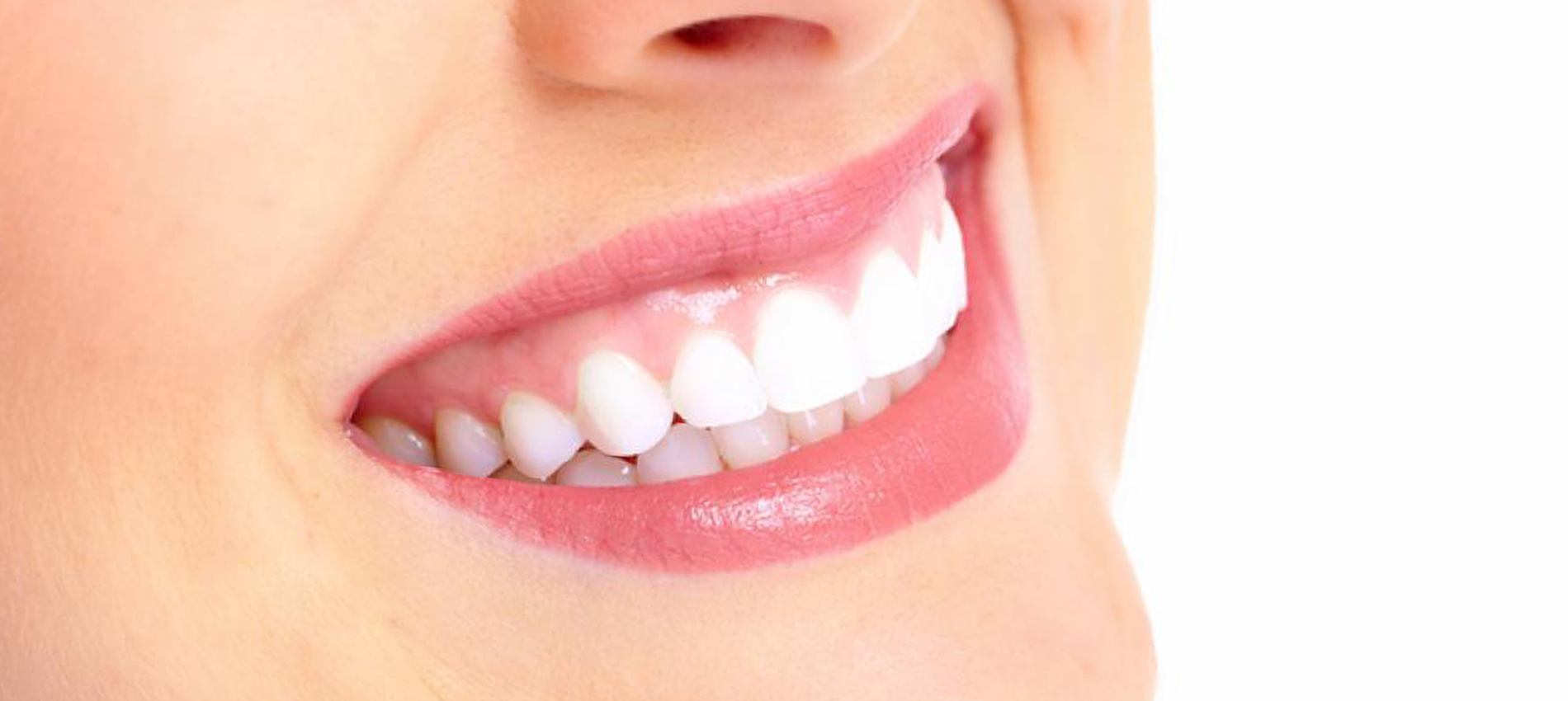 Distributie Speciaal Onverenigbaar Blog - Hoe krijg ik witte tanden? - Boozyshop