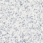 Marazzi Frammento MN1L 60X60 Macro Azzuro 9mm Mat R10, afname per doos van 1,08 m²