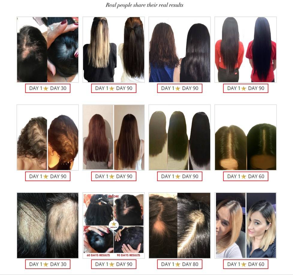 Hairtamin Vitamins 2 Month Monolith Beauty Lifestyle