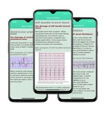 Stuff Certified® E86 ECG Smartwatch avec Bracelet Supplémentaire - Montre Fitness Sport Activity Tracker Android - Bracelet en Cuir TPU Noir