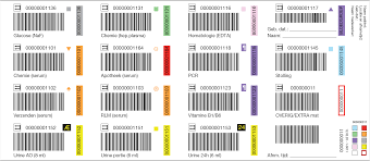 Toeslag voor speciaal product