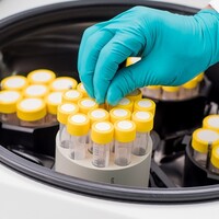 Laboratorium centrifuges