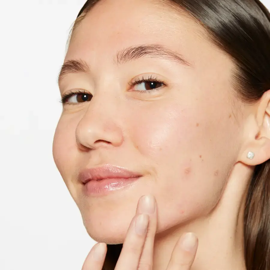 Active Clearing Breakout Biotic Moisturizer 50ml