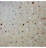 Klimex UltraStrong Terrazzo Round Beige